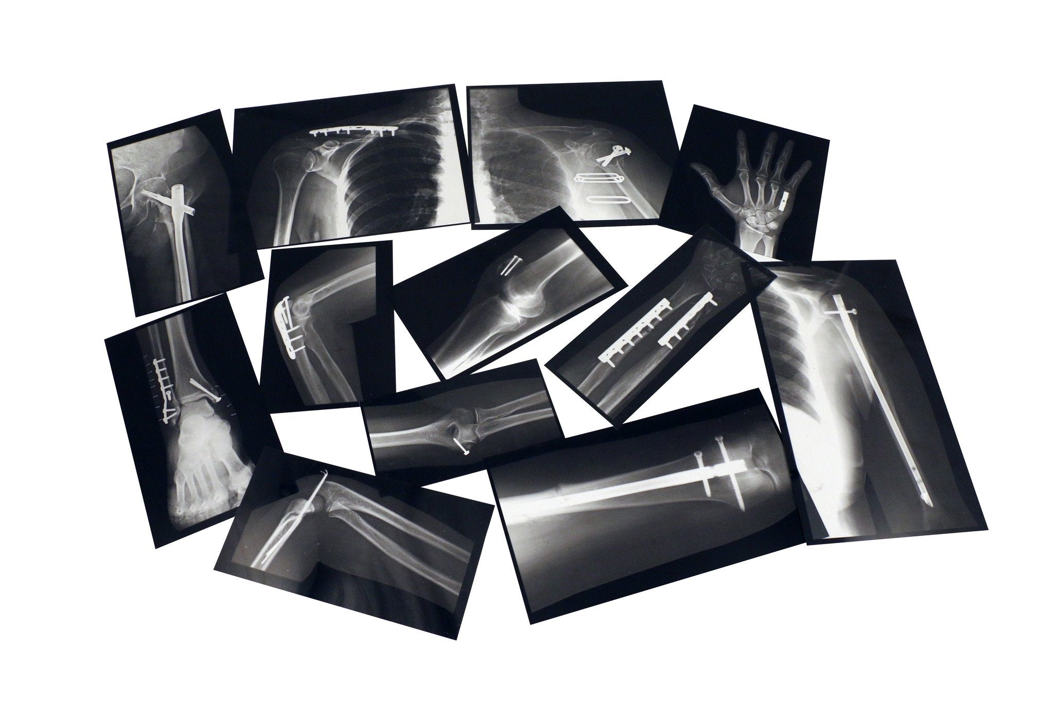 RoylcoÂ® Fixed Bones X-Rays